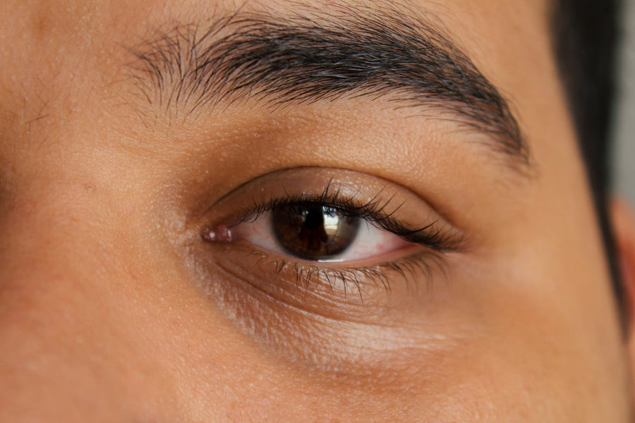Why Does Cannabis Make Your Eyes Red? Causes & Fixes